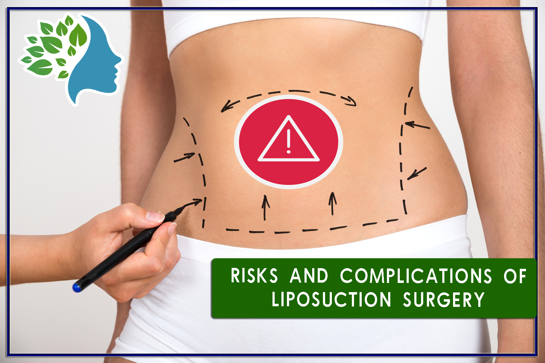 Risks and complications of liposuction surgery - what to do