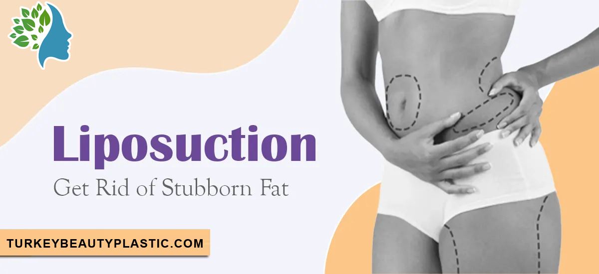 liposuction